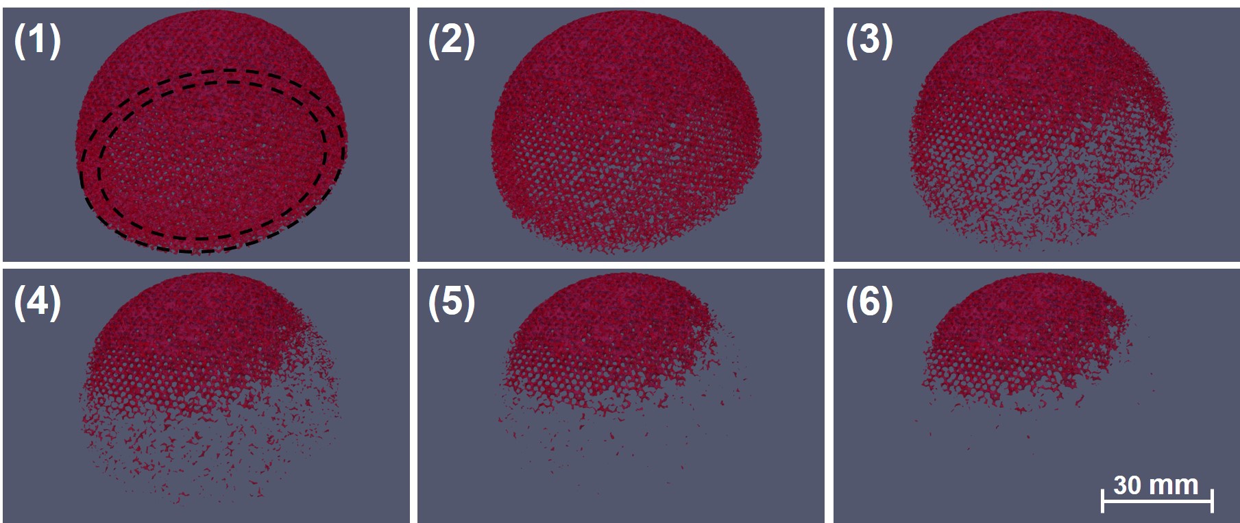 Visualization of the change of morphology of the acetabular implant over time (1) to (6).