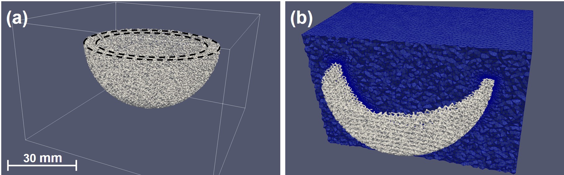 The computational biodegradation model for the porous acetabular implant: a) the optimized acetabular implant embedded inside a cubic container, b) a cross-section of the generated mesh with the implant’s surface visualized as the light gray surface.