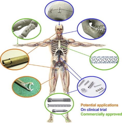 Various potential applications of Mg as a biodegradable metallic biomaterial for cardiovascular and orthopedic implants and devices 